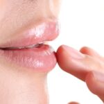 Lip-Flip-Filler-in-Richmond-BC